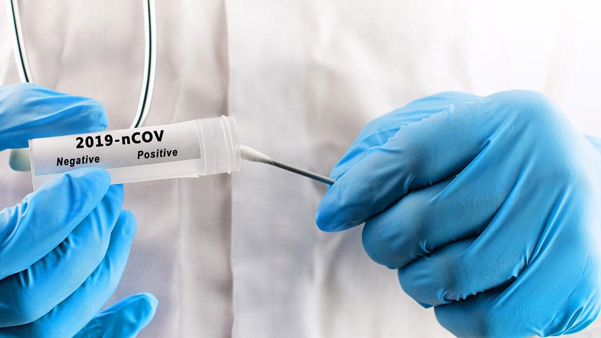 Doç. Dr. Ümit Savaşçı: Koronavirüs Temaslıları, PCR Testini En Erken 3 Gün Sonra Yaptırmalı