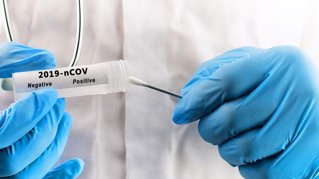 Doç. Dr. Ümit Savaşçı: Koronavirüs Temaslıları, PCR Testini En Erken 3 Gün Sonra Yaptırmalı