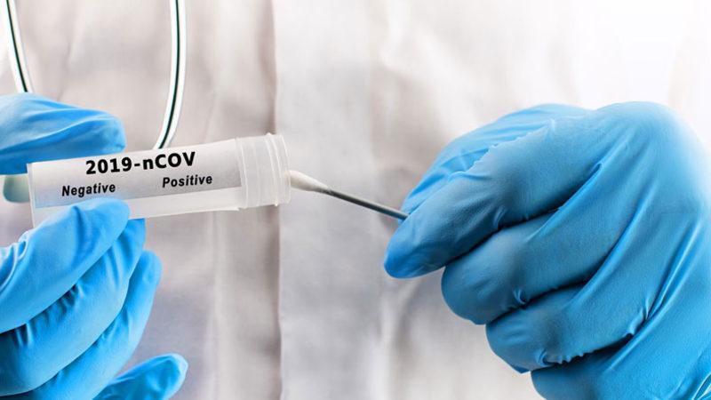 Doç. Dr. Ümit Savaşçı: Koronavirüs Temaslıları, PCR Testini En Erken 3 Gün Sonra Yaptırmalı