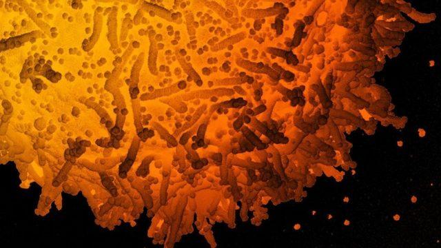 Türkiye’de En Çok Görülen Koronavirüs Mutasyonları Açıklandı