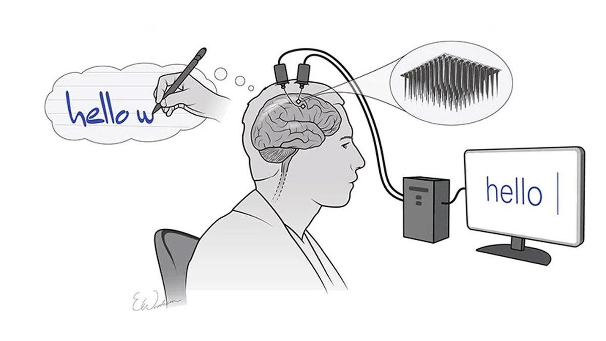 Felçli Bir Birey, Düşünceleri Yazıya Çeviren Yapay Zeka Sistemiyle Yazı Yazdı