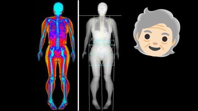 Boyumuz 35 Yaşından Sonra Neden Kısalmaya Başlar? Sebebini Öğrenince Ufak Bir Burukluk Hissedebilirsiniz!