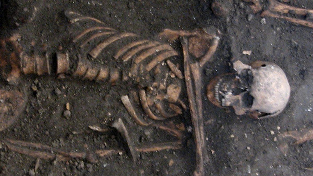 Dudakta Çıkan Uçukların İlk Kez ’Öpüşmekten’ Yayılmış Olabileceği Keşfedildi