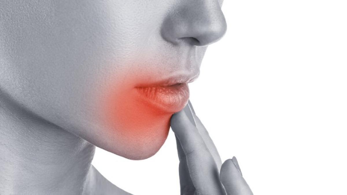 Dudakta Çıkan Uçukların İlk Kez ’Öpüşmekten’ Yayılmış Olabileceği Keşfedildi