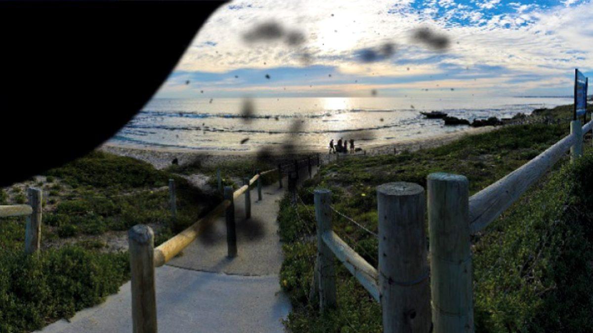 Farklı Çeşitlerde Görme Bozukluğu Olan İnsanlar Dünyayı İşte Böyle Görüyor!