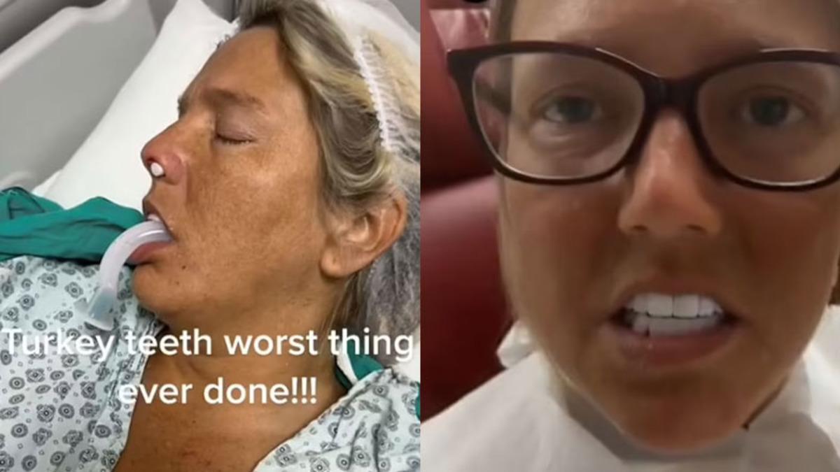 Türkiye’de Diş Tedavisi Gören İngiliz’in İsyanı Dünya Basınında: "Ağzımdan Vurulmuş Gibi Hissediyorum"
