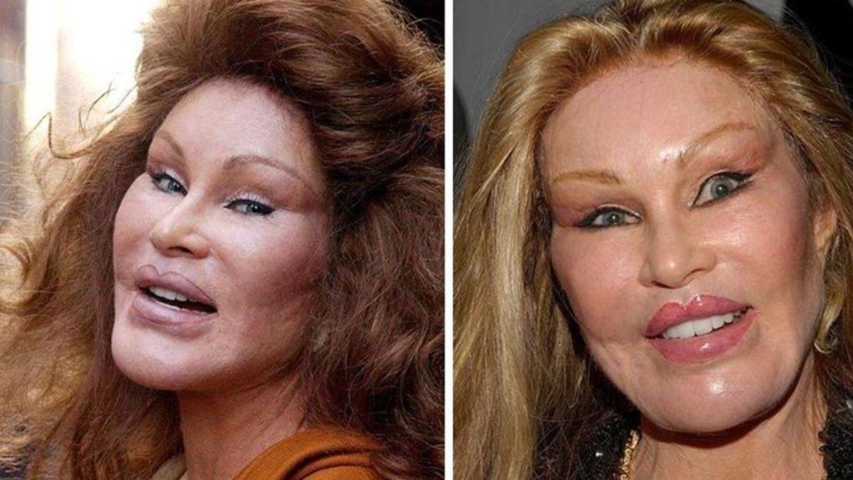 Bir İnsanı ’Tuhaf Görünecek Kadar’ Estetik Bağımlısı Olmaya İten Psikolojik ve Sosyolojik Faktörler