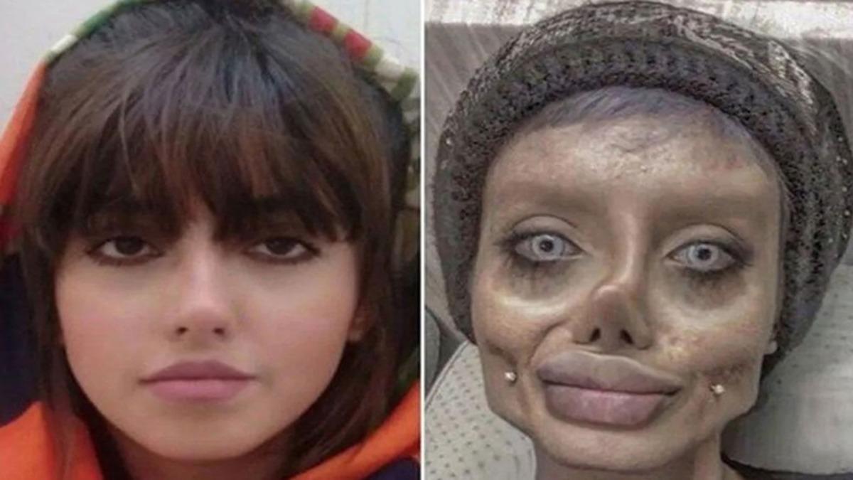 Bir İnsanı ’Tuhaf Görünecek Kadar’ Estetik Bağımlısı Olmaya İten Psikolojik ve Sosyolojik Faktörler