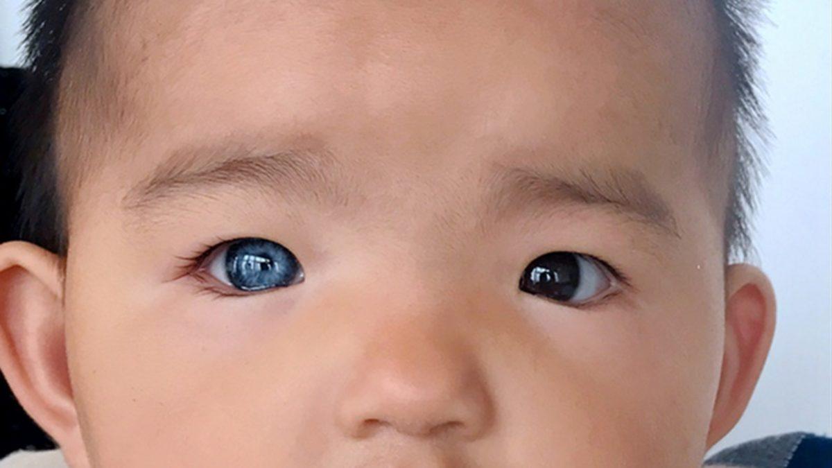 Siyahi İnsanlarda Mavi Göz Görülmesinin Öğrenince Bilime Hayran Bırakan İlginç Nedeni