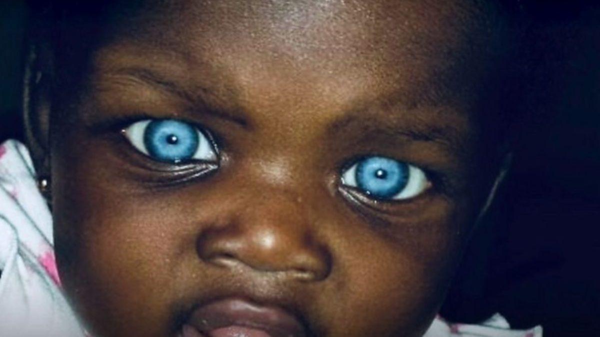 Siyahi İnsanlarda Mavi Göz Görülmesinin Öğrenince Bilime Hayran Bırakan İlginç Nedeni