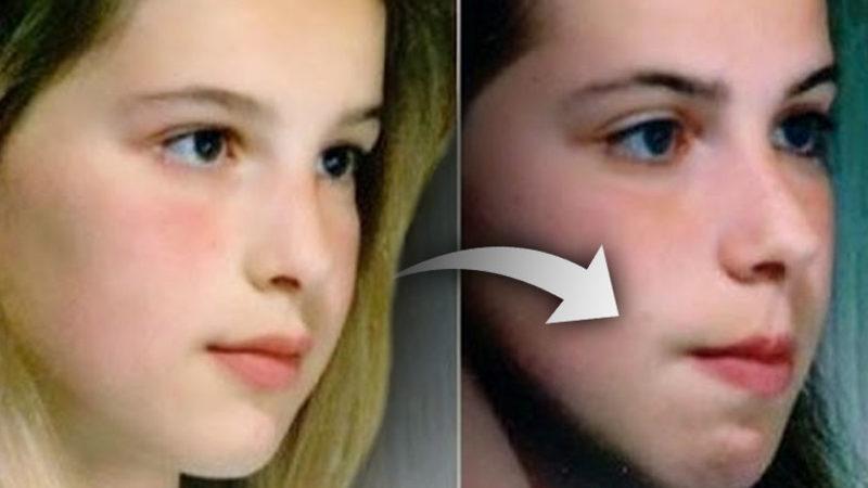 Geceleri Uyurken Burun Yerine Ağızdan Nefes Alınca Yüz Şekliniz Böyle Değişebilir! Peki Neden?