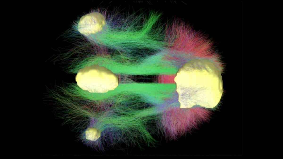 İstemsizce Uzaklara Dalıp Gittiğimiz Anlarda Beynimizin Verdiği İlginç Sinyaller