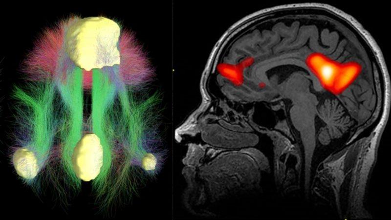 İstemsizce Uzaklara Dalıp Gittiğimiz Anlarda Beynimizin Verdiği İlginç Sinyaller