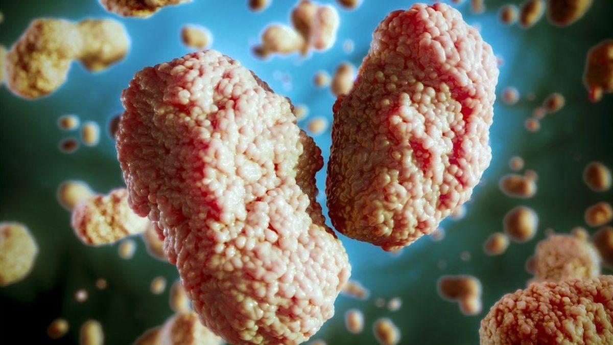 DSÖ, Maymun Çiçeği Virüsünün İsmini Değiştiriyor (Bundan Sonra Virüslere Ülke İsmi Verilmeyecek)