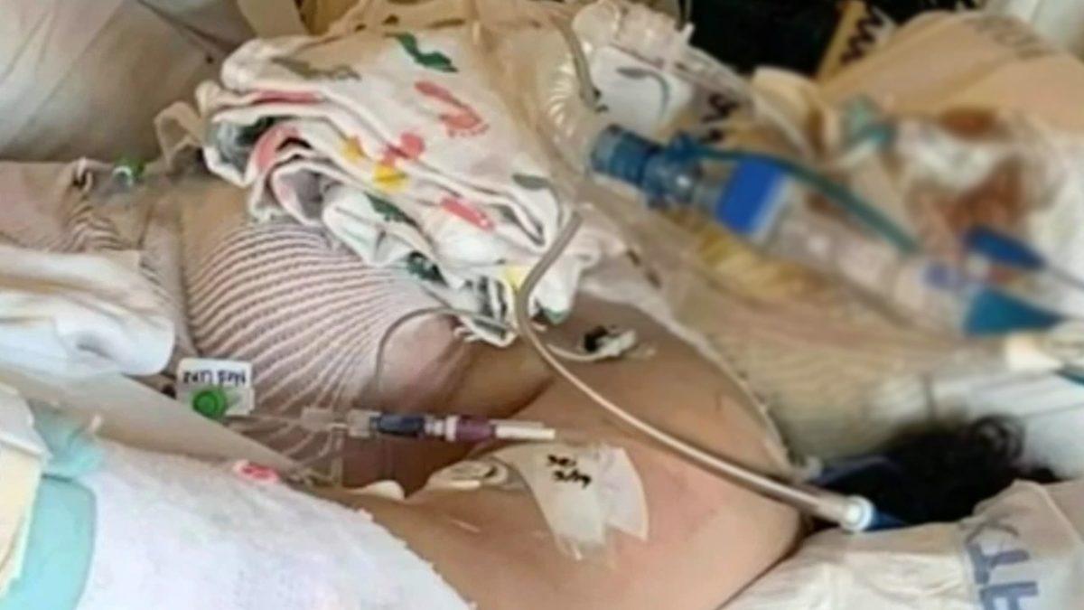 TikTok Akımına Katılmak İsteyen 13 Yaşındaki Çocuk, Alevler İçinde Kaldı