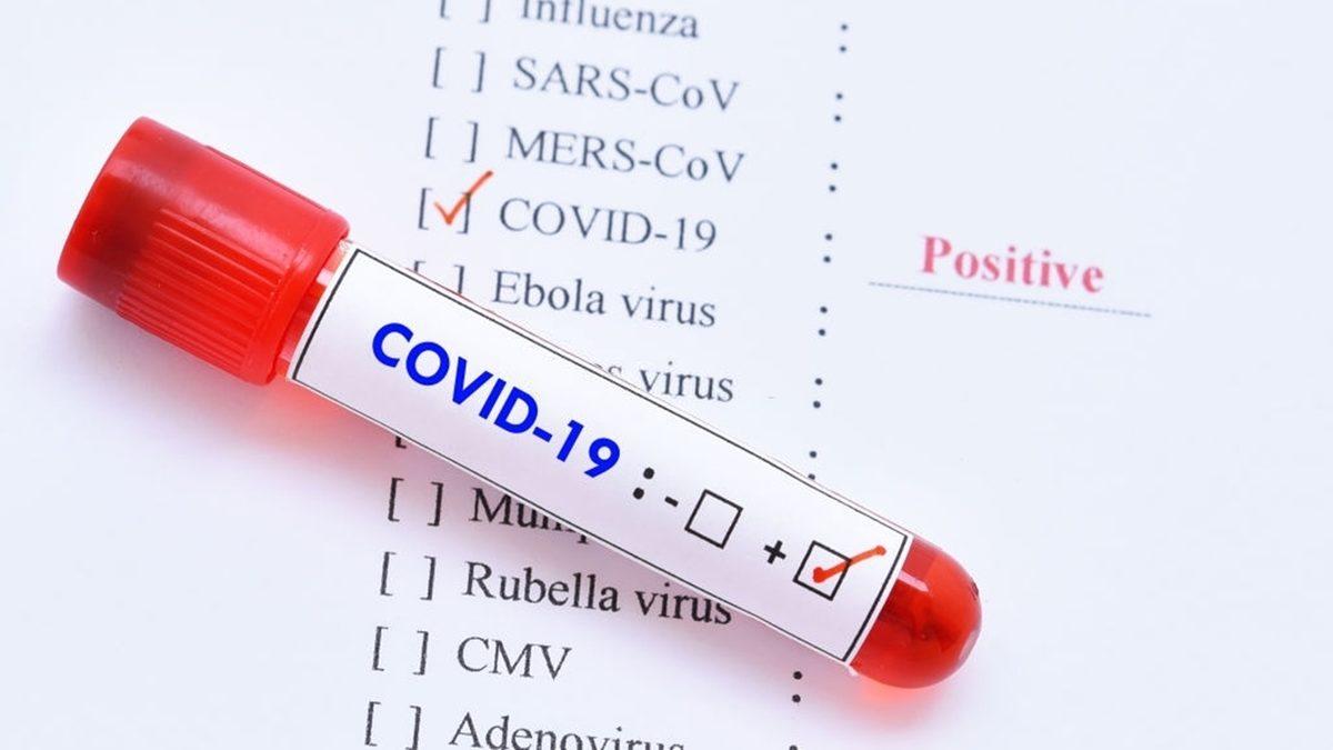 Son Dönemde Neden Bu Kadar Çok Virüs Çeşidi Ortaya Çıktı? Bir Uzmana Sorduk...