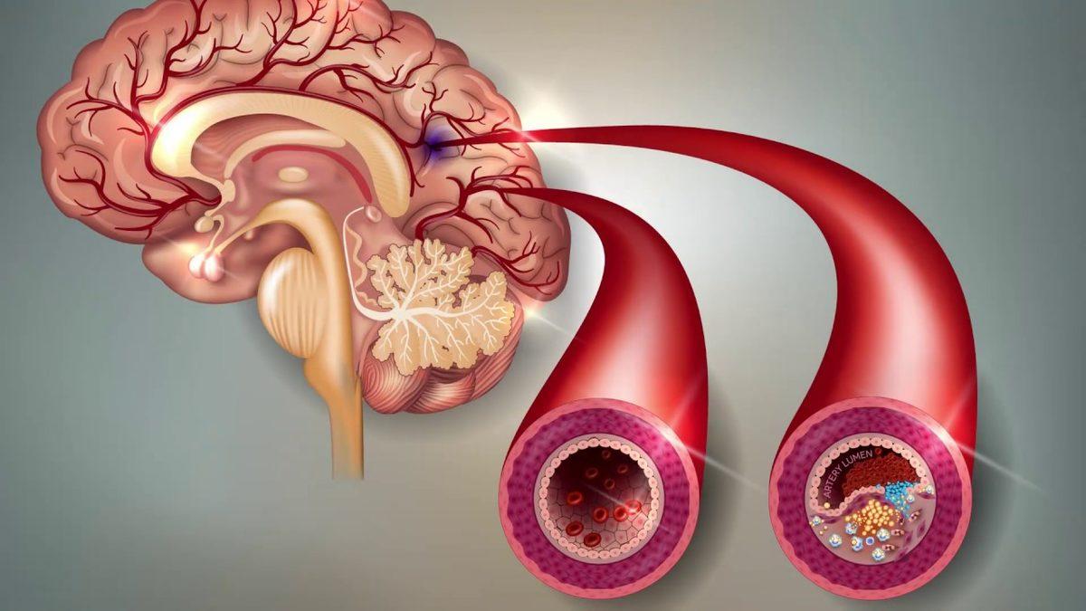 Kan Grubunuzu Biliyor musunuz? Nasıl Belli Olduğunu, Uyumsuz Bir Transferde Neler Olabileceğini Anlattık