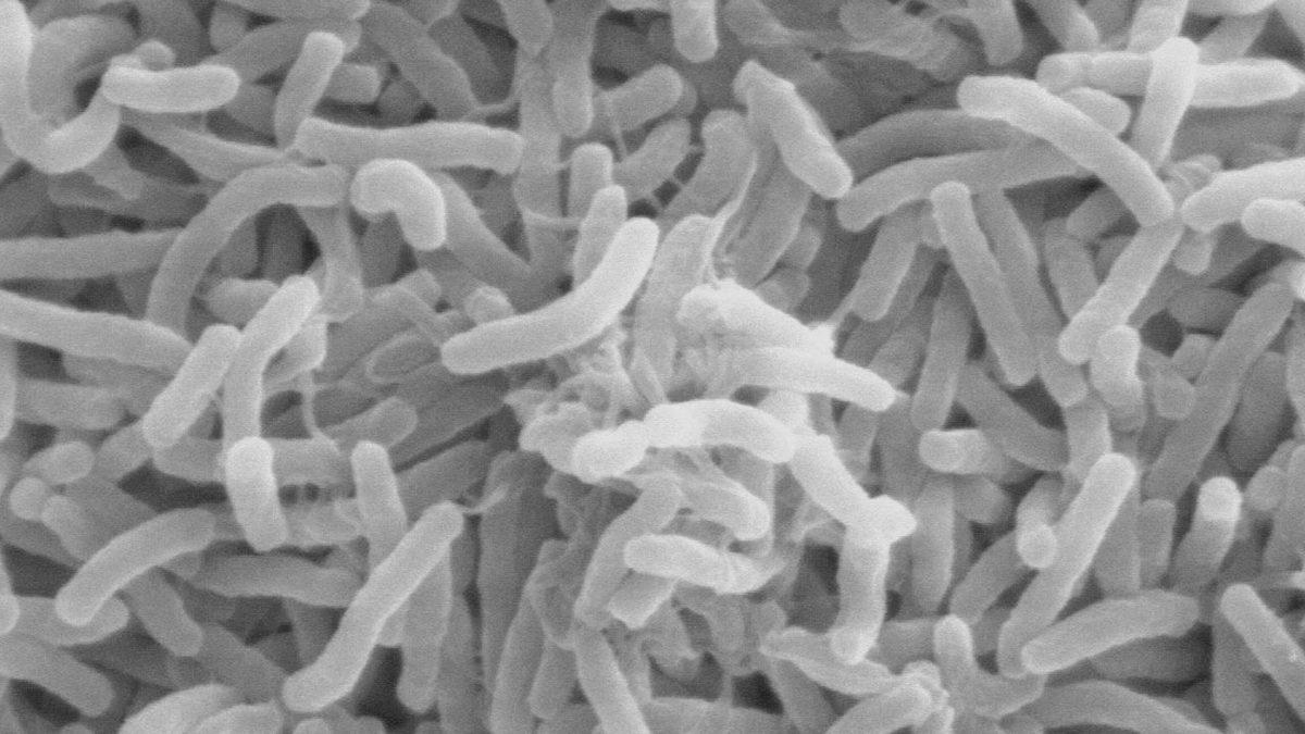 Marmara’daki Deniz Salyasının Neden Olacağı İddia Edilen ’Kolera Salgını’ Nedir, Belirtileri Neler?