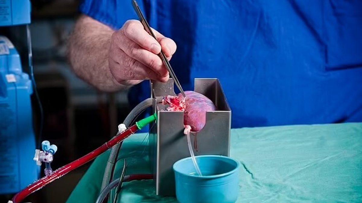 Organ Nakli Konusunda Tarihi An: Nakledilecek Organın Kan Grubu Değiştirildi!