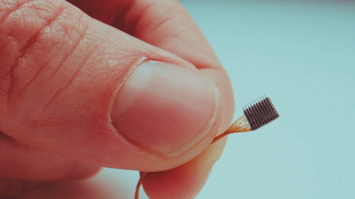 7 Yıldır Beyin-Bilgisayar Arayüzüyle Yaşayan Adam Tarihe Geçti: İşte Gerçek Cyborg!