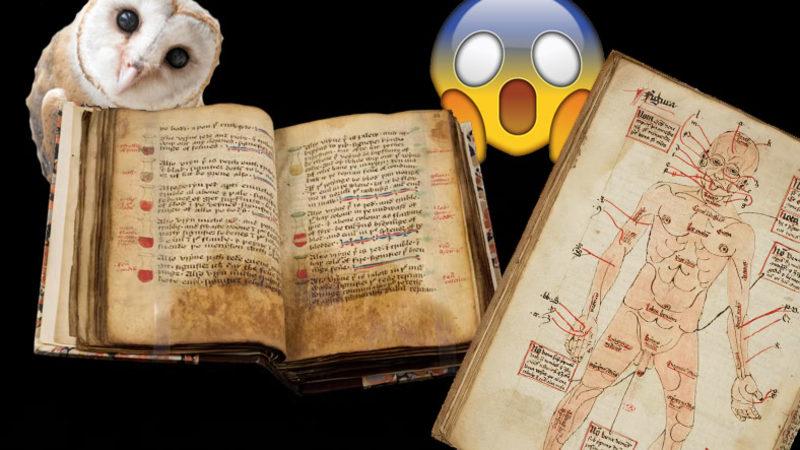 Orta Çağda Kullanılan "Bunu Nasıl Yaptınız" Dedirten Akıl Almaz Tedavi Yöntemleri Herkesle Paylaşılacak [Evde Denemeyin!]