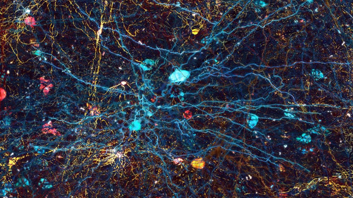 İnsan Vücudunda En Fazla Ortak Noktaya Sahip İki Organ Belirlendi: Beyin ve Testisler