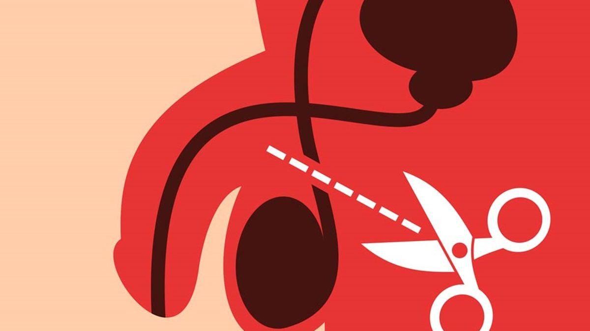 Erkeklere Uygulanan Kısırlaştırma Sonrasında Spermler Nereye Gidiyor?