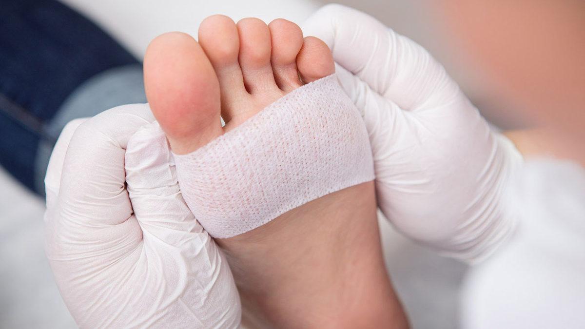 Özellikle Geceleri Ortaya Çıkıp Dayanılmaz Olabilen ’Ayak Yanması’ Aslında Neden Olur, Ne İyi Gelir?