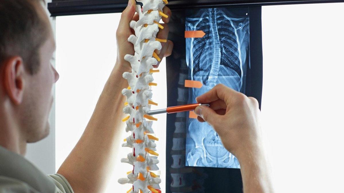 Genellikle Bilgisayar Başında Çalışanların Yaşadığı ’Boyun Düzleşmesi’ Nedir, Belirtileri Nelerdir, Nasıl Geçer?