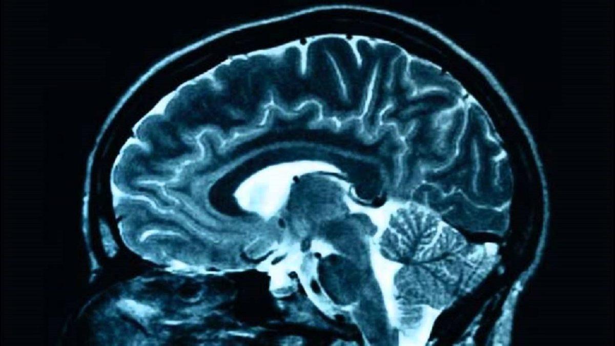 ’Ben Bir Gördüğümü Bir Daha Unutmam’ Diyenler Toplansın: Fotoğrafik Hafıza Diye Bir Şey Gerçekten Var mı?