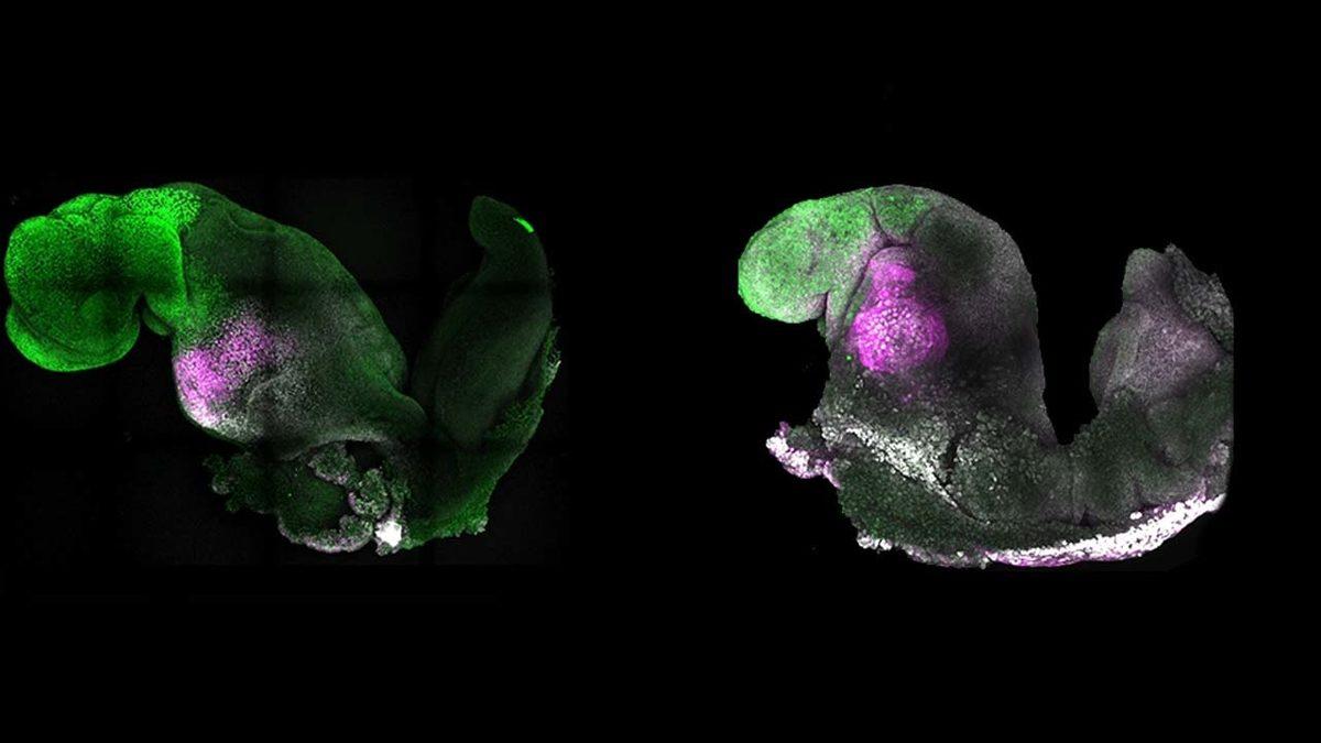 Tarihte İlk Kez Sperm ve Yumurta Olmadan Oluşturulan Embriyolarda Kalp ve Beyin Gelişimi Görüldü: Laboratuvarda Canlı Üretmek Gerçek mi Oluyor?