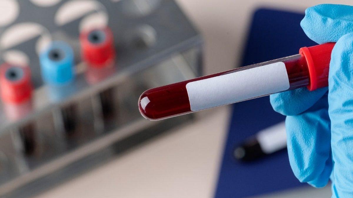 Bazı Kan Gruplarının Erken Yaşta Felç Geçirme Riskini Artırdığı Ortaya Çıktı