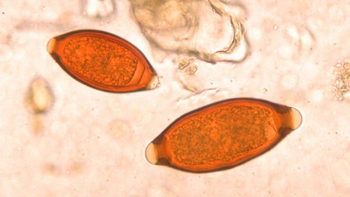 2.500 Yıllık Viking Kakası Sayesinde Bugün Bile Vücudumuzda Bulunan Parazitler Hakkında Keşif Yapıldı