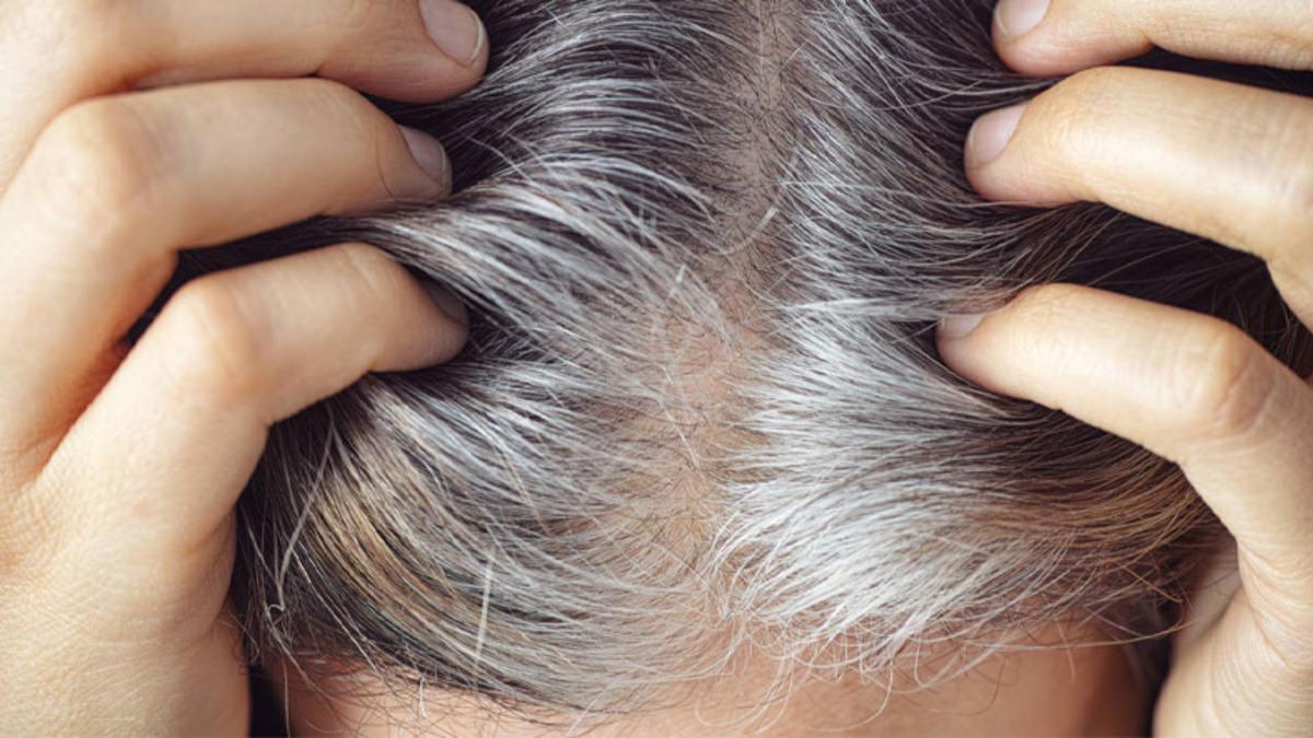 Stresin Saç Beyazlamasına Sebep Olduğu Doğrulandı: Geri Döndürülebiliyor