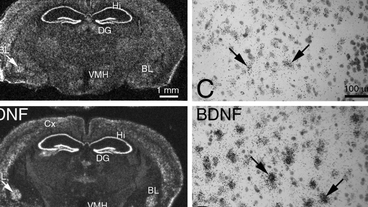 Öğrenme Yeteneğinizi En Üst Seviyeye Çıkaran Beyninizdeki ’BDNF Proteini’ Nasıl Artırılır?