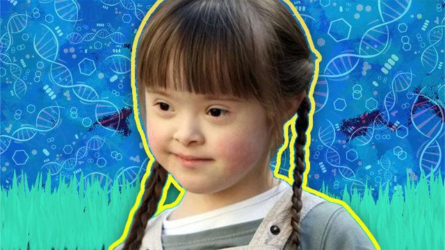 Bir Genetik Mühendisine Sorduk: Down Sendromlu Bireylerin Yüzleri Neden Birbirine Benzer?