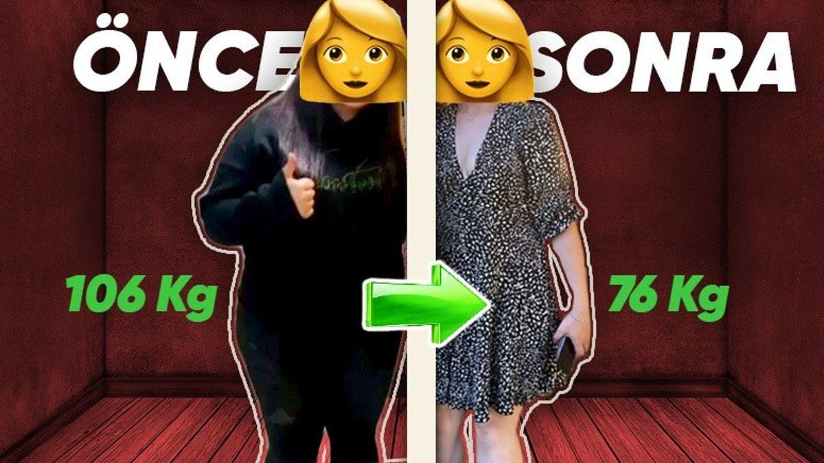 Tüp Mide Ameliyatı Sayesinde 30 Kilo Veren Birine Bu Süreçte Yaşadıklarını Sorduk: Midenin Bir Kısmının Alınması Nasıl Bir His?