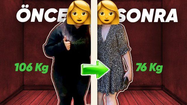 Tüp Mide Ameliyatı Sayesinde 30 Kilo Veren Birine Bu Süreçte Yaşadıklarını Sorduk: Midenin Bir Kısmının Alınması Nasıl Bir His?