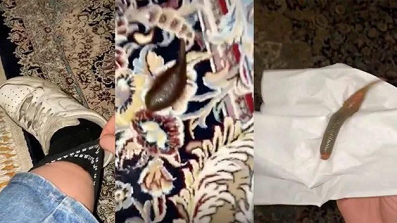 TikTok Fenomeninin Çorabından Kan Emici Sülük Çıkardığı Viral Video