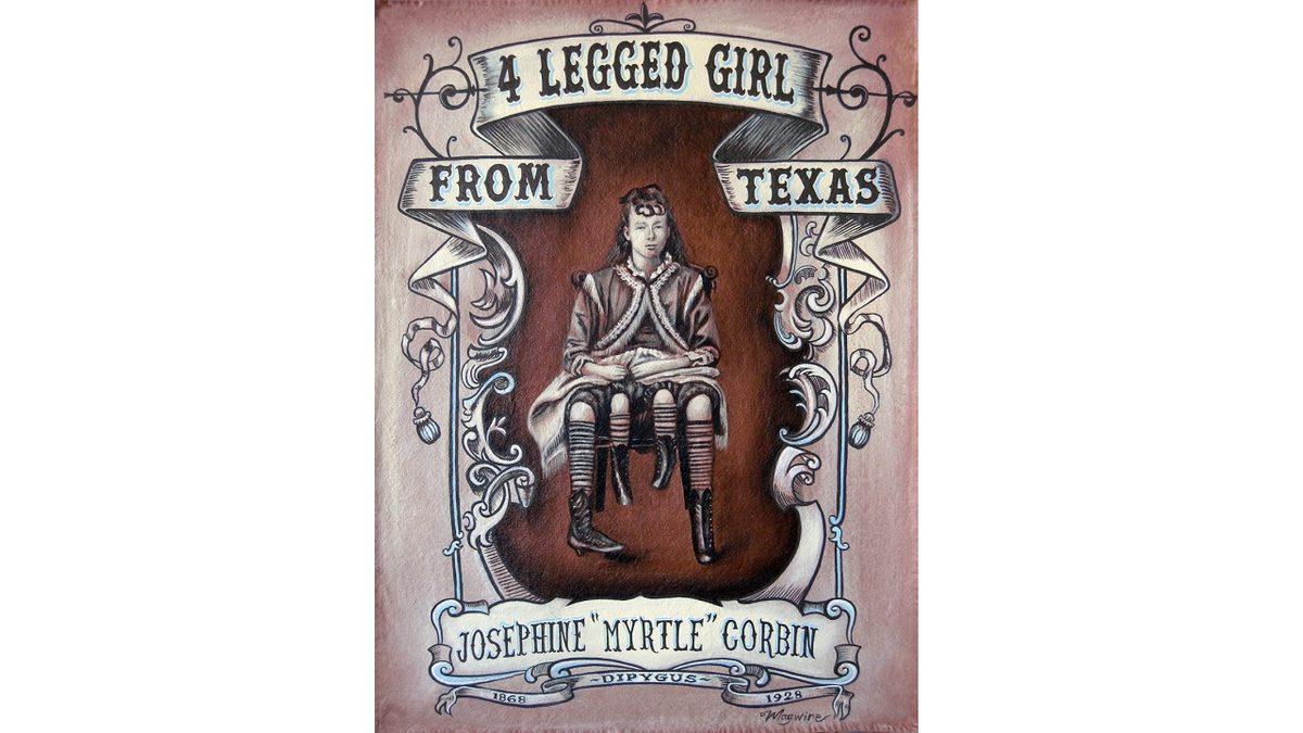 Dört Bacak ve İki Rahimle Doğan Kadın Myrtle Corbin’in Akıl Almayacak Hayat Hikayesi