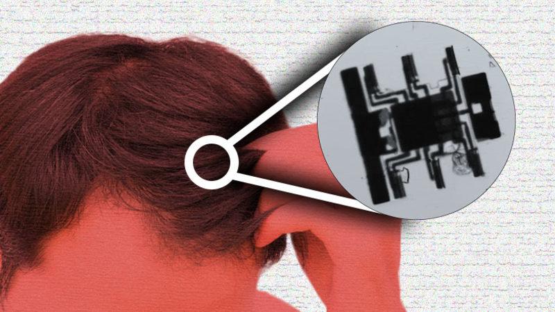 Tek Bir Saç Telinin Üzerinde Halay Çekebilecek Kadar Küçük Robot Geliştirildi: Peki Ne İşe Yarayacak?