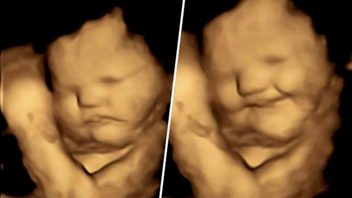 Bu Görüntüler Anne Karnında Çekildi: Bebeklerin Doğmadan Önce Tat ve Koku Alabildikleri Kanıtlandı!