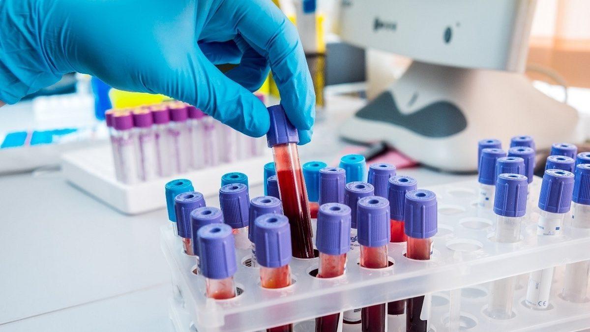 Tükettiğimiz Besinlerin Enerjiye Dönüşmesini Sağlayan ALT Enzimi Yükseldiğinde ve Düşüklüğünde Ne Yaşarız?