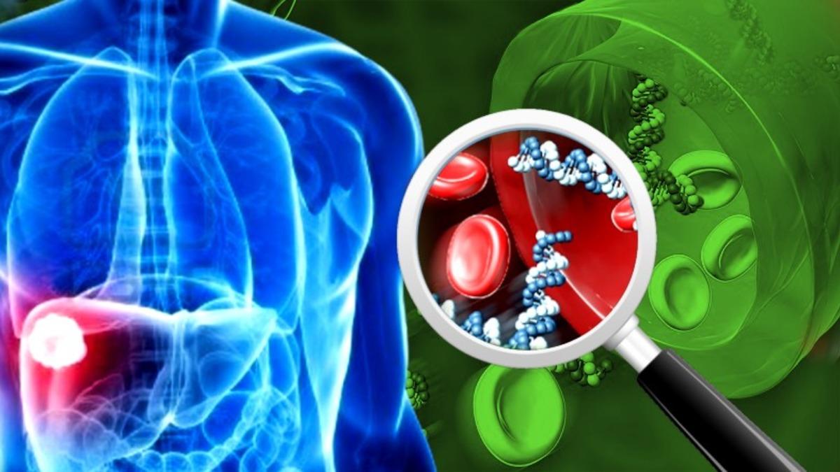 Tükettiğimiz Besinlerin Enerjiye Dönüşmesini Sağlayan ALT Enzimi Yükseldiğinde ve Düşüklüğünde Ne Yaşarız?