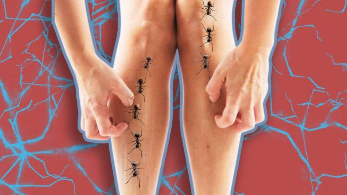 Böcekler Hakkında Konuştuğumuzda ya da Bir Böcek Fotoğrafı Gördüğümüzde Bile Deli Gibi Kaşınmamızın Nedeni