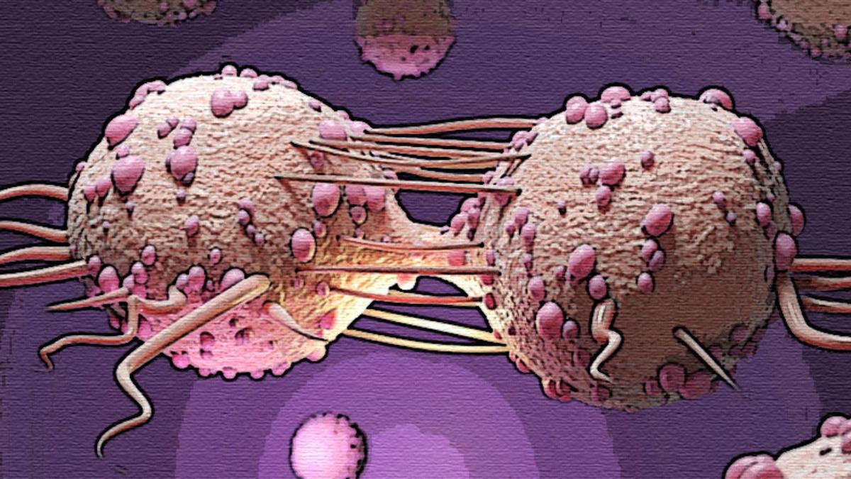 Kanser Hücrelerini Öldüren Virüs Geliştirildi: Tümörü Tamamen Yok Etti!