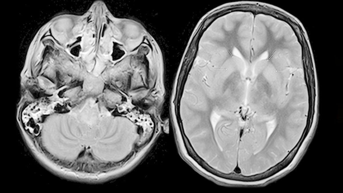 Kuduza Yakalanan Biri Su Görünce Neden Bu Kadar Çok Korkar?