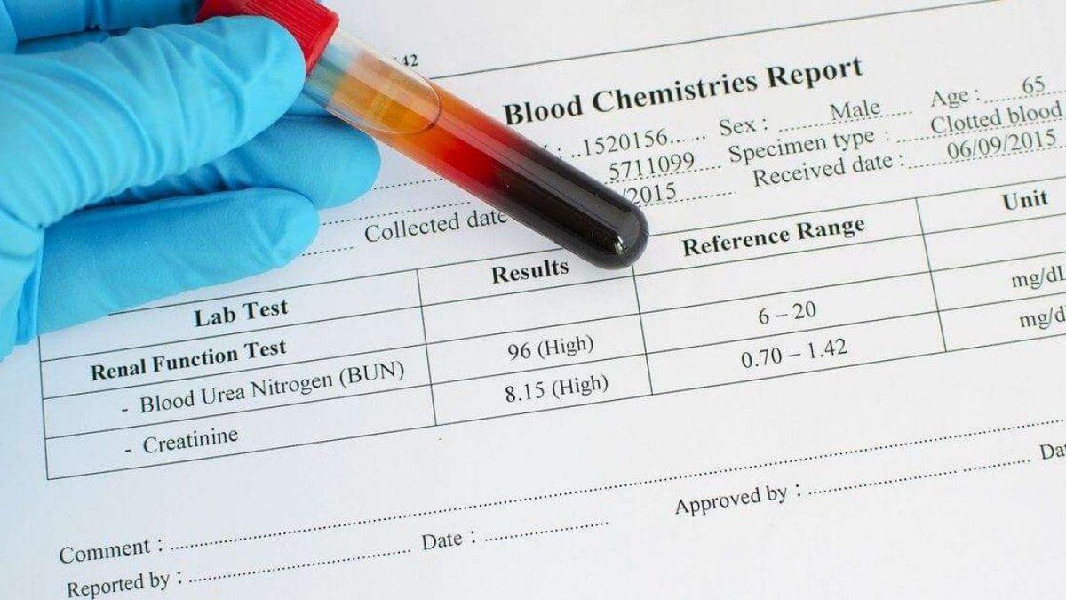 Böbreklerin Sağlıklı Olup Olmadığını Gösteren Kreatinin Nedir? Ne İşe Yarar?