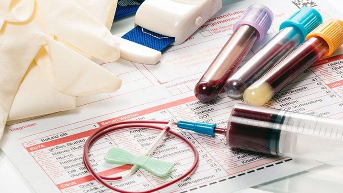 Böbreklerin Sağlıklı Olup Olmadığını Gösteren Kreatinin Nedir? Ne İşe Yarar?