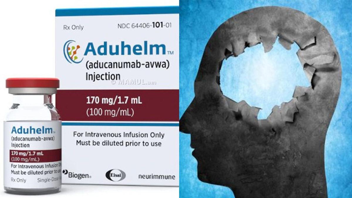 Onaylanan Alzheimer İlacı Hakkında Yeni Çalışma: İşe Yaradığına Dair Kanıt Yok, Ederinden Çok Yüksek Fiyata Satılıyor